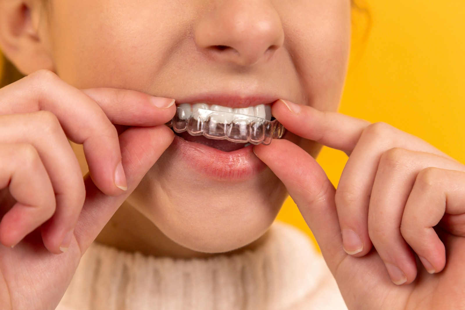 Zirconia crowns